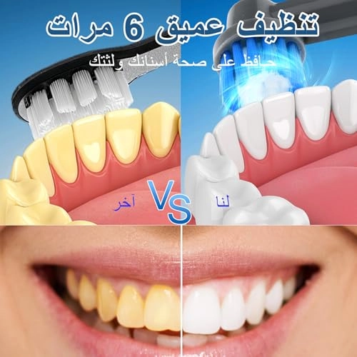 Rotating Electric Toothbrush - IPX7 Waterproof 2-Min Smart Timer Wireless Charging