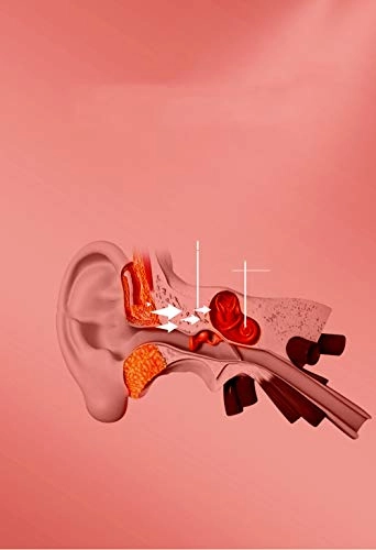 Bone Conduction Wireless Headset