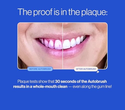 Sonic Pro - U-Shaped 30-Second Rechargeable