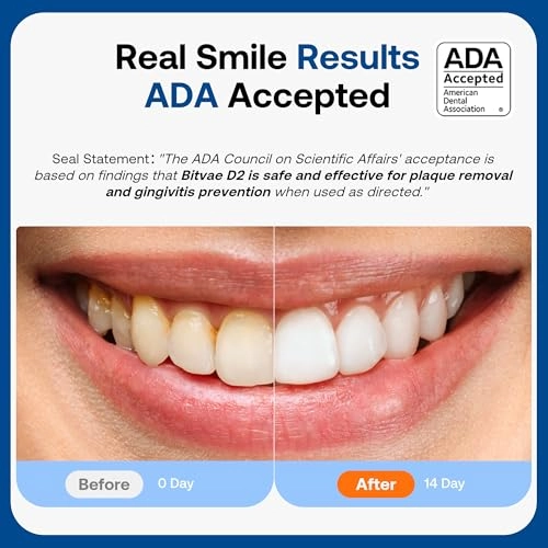 D2 - 40000 movements per minute 8 Replacement Heads 5 Modes