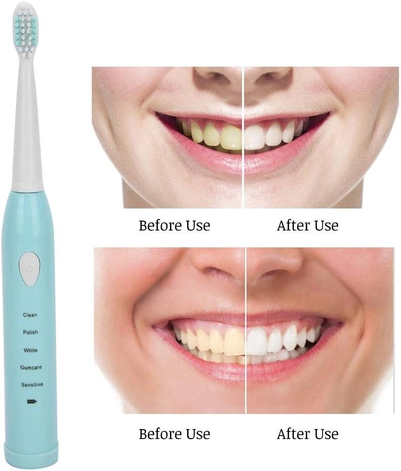Sonic Electric Toothbrush - 1200mAh 5 Modes IPX7
