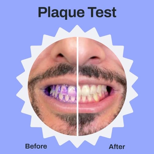 Sonic Pro - U-Shaped 30-Second Rechargeable