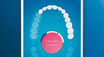 Guides your brushing and highlights missed areas