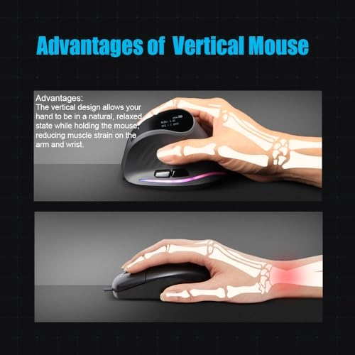 F35 Vertical Ergonomic Mouse - Wireless