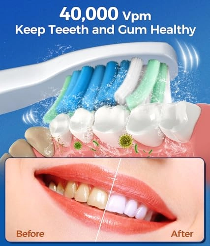 Electric Toothbrush - 40000 VPM 5 Modes Pink