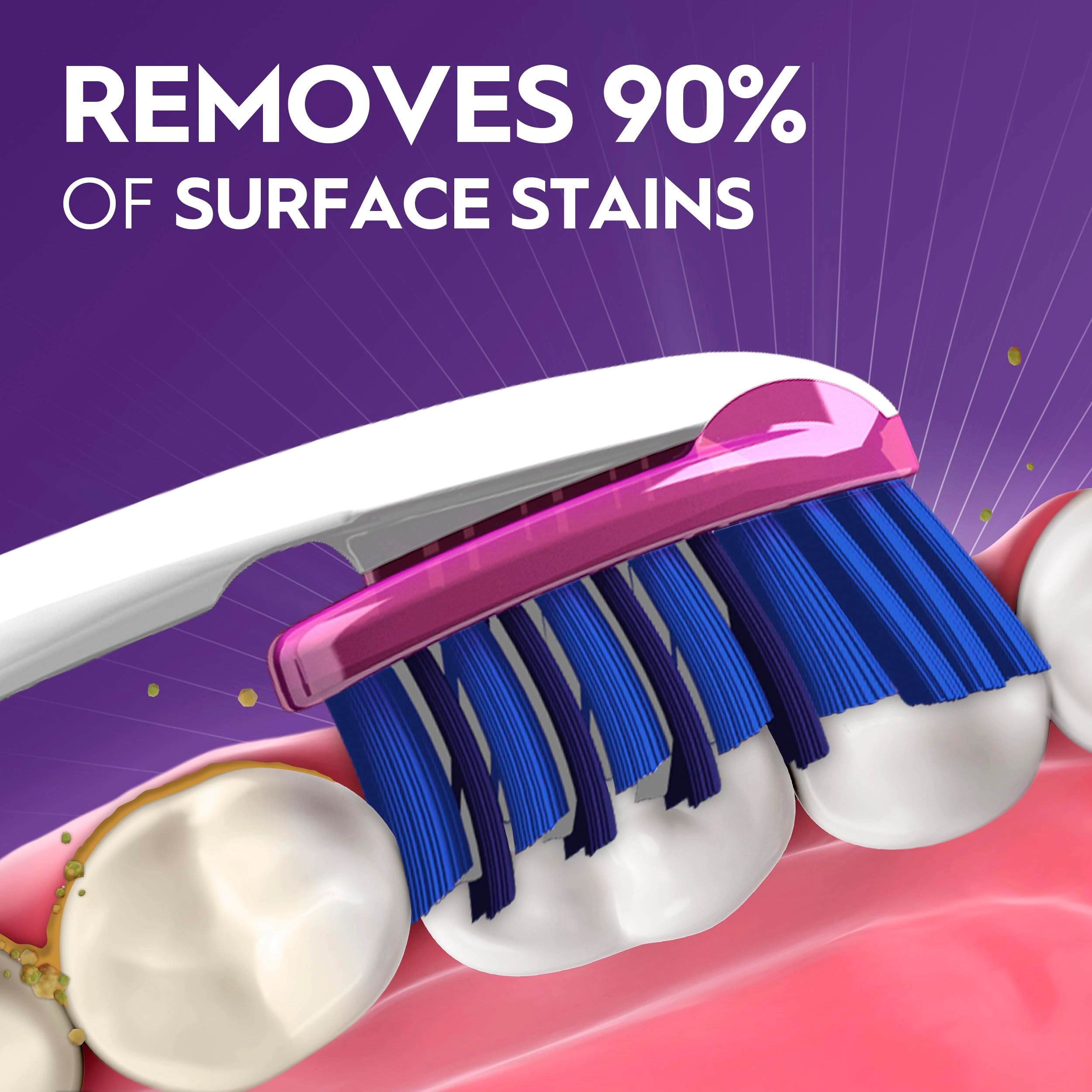 Pro-Flex Stain Eraser - Soft