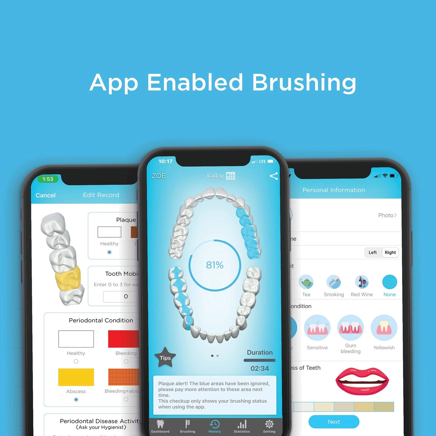 Smart Bluetooth Enabled Kids Toothbrush - Live Tracking App Wireless Rechargeable