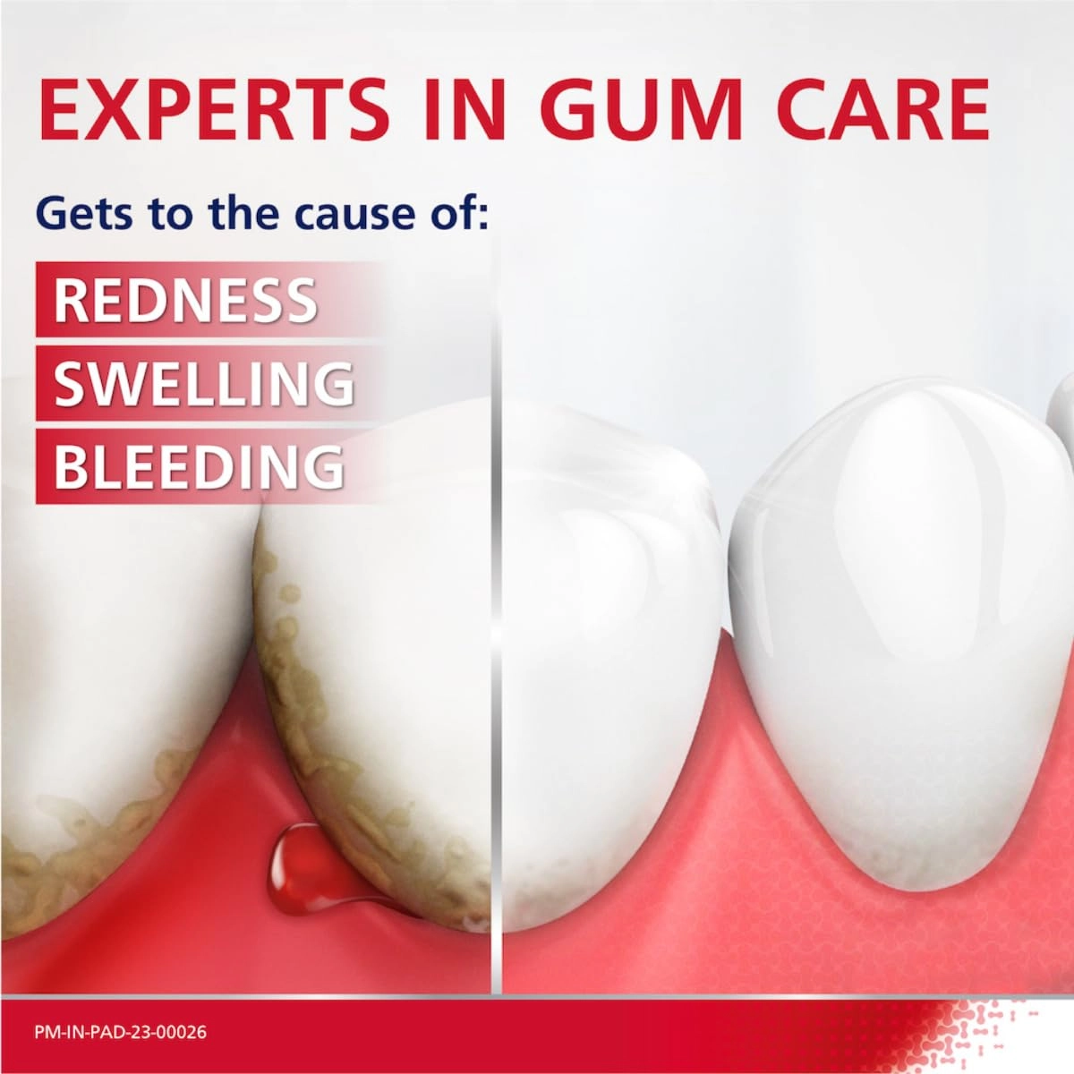 Expert Gum Care Fluoride Fresh Toothpaste Adult 75 g