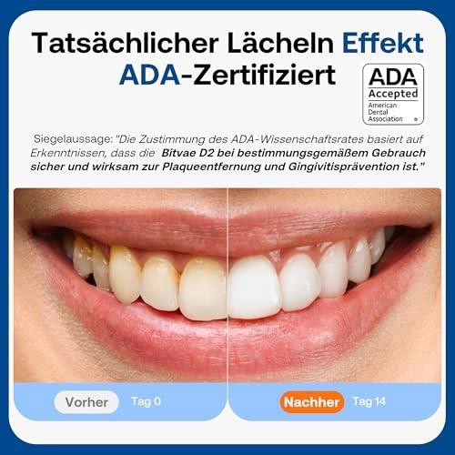 D2 - 40000 movements per minute 8 Replacement Heads 5 Modes