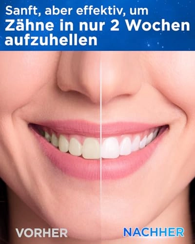 Y08U - 8 Brush Heads 120 Days Battery Life USB C