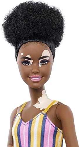 Barbie Fashionistas - #135 Vitiligo Ages 3+