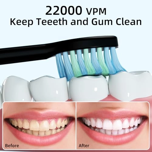 Sonic Electric Toothbrush - 8 Duponts Brush Heads 2 Minute Smart Timer 6 Modes
