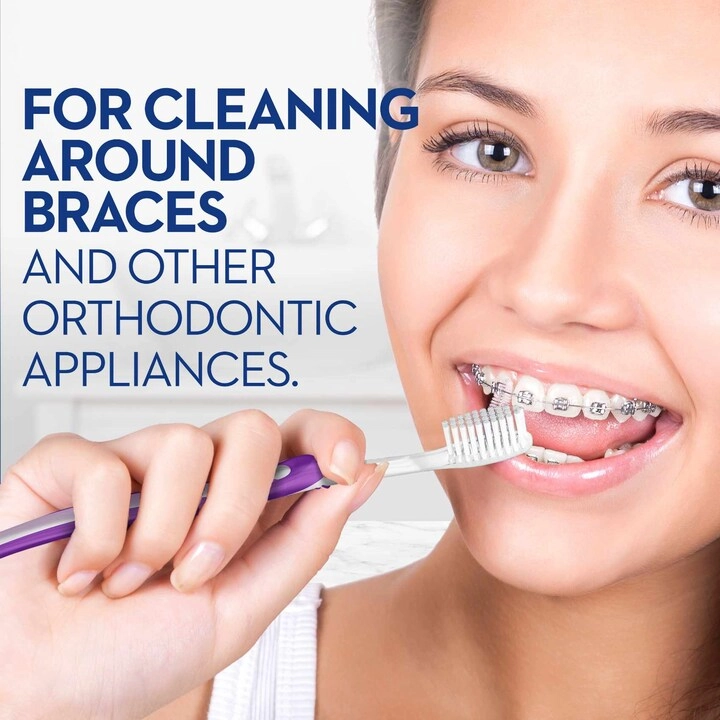 Pro-Expert Ortho Orthodontic 35 - Soft