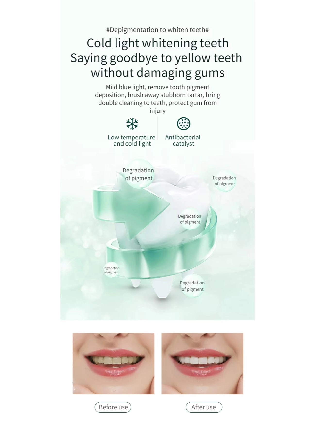 Ultrasonic Teeth Cleaner - U-Shaped 30,000 VPM USB Rechargeable