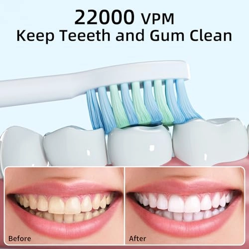 Sonic Electric Toothbrush - 8 Duponts Brush Heads 2 Minute Smart Timer 6 Modes