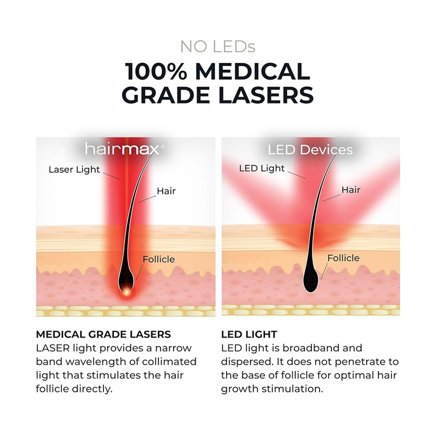 Ultima 12 Classic - Laser Comb 50 W