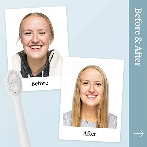 Sonic Toothbrush - 2-Minute Self Timer 3 Speed 48000 Reps/Min