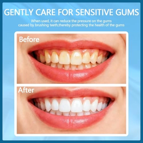 Sonic Electric Toothbrush - 3 Intensity Levels 5 Modes 40000 VPM