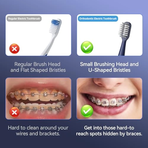 J40 - Sonic 5 Modes 6 Brush Heads