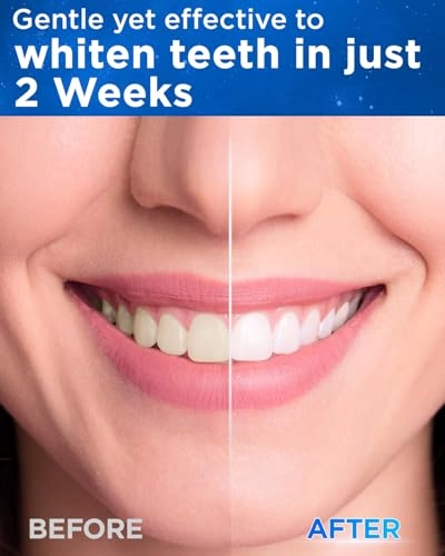 Y08U - 8 Brush Heads 120 Days Battery Life USB C