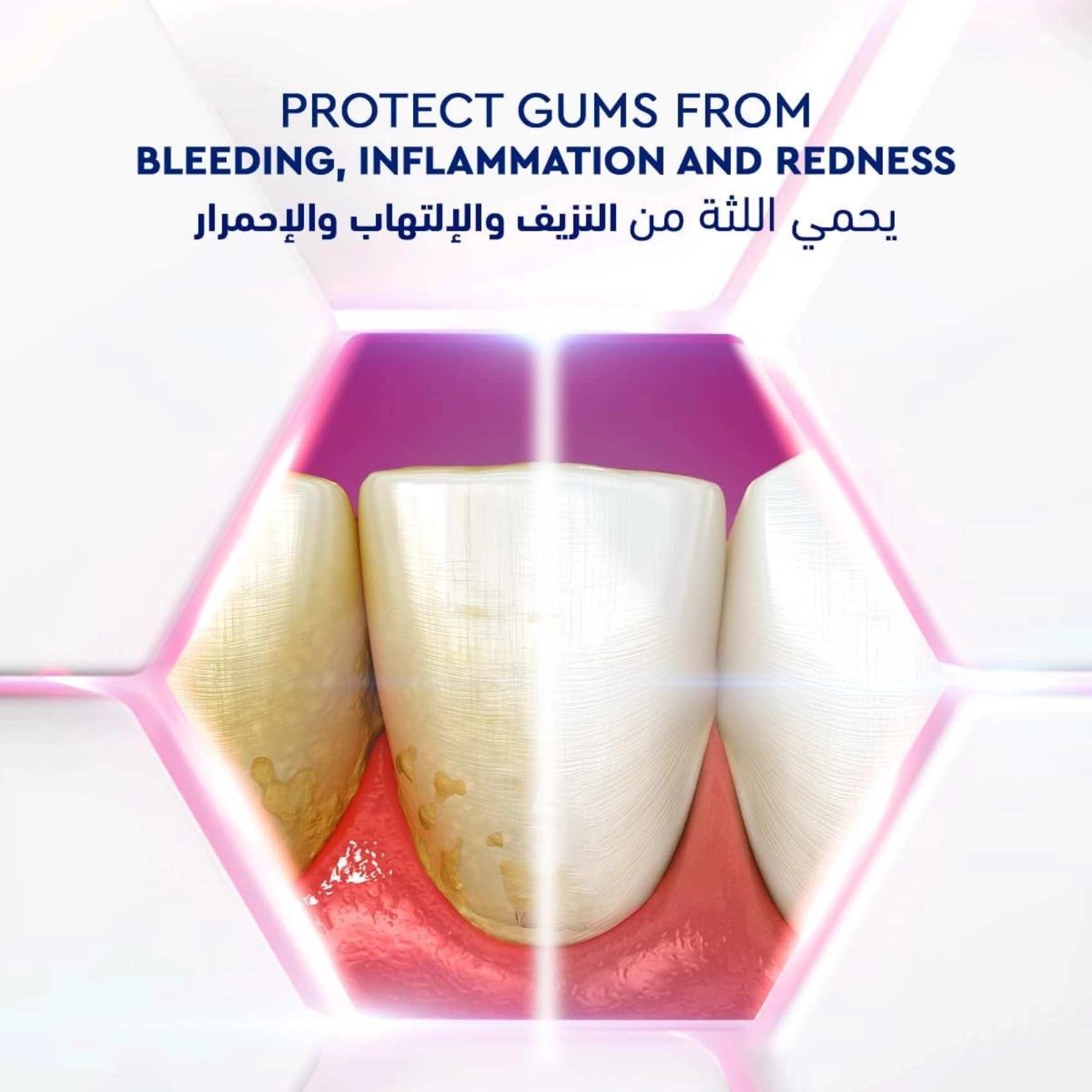 Gum Expert Whitening Toothpaste 75ml Pack of 2