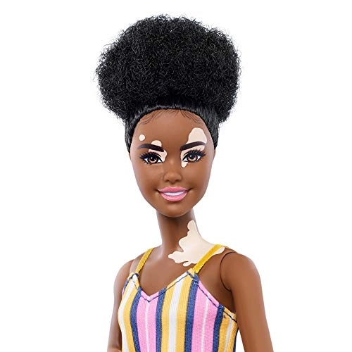 Barbie Fashionistas - #135 Vitiligo Ages 3+