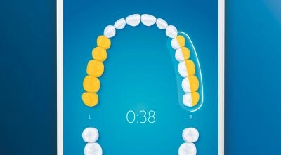 Takes you back to any missed spots for 100% coverage