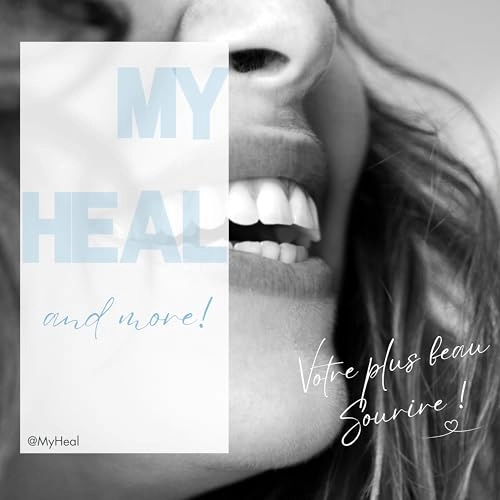 Replacement Brush Heads - Pack of 4 Blue Sonic