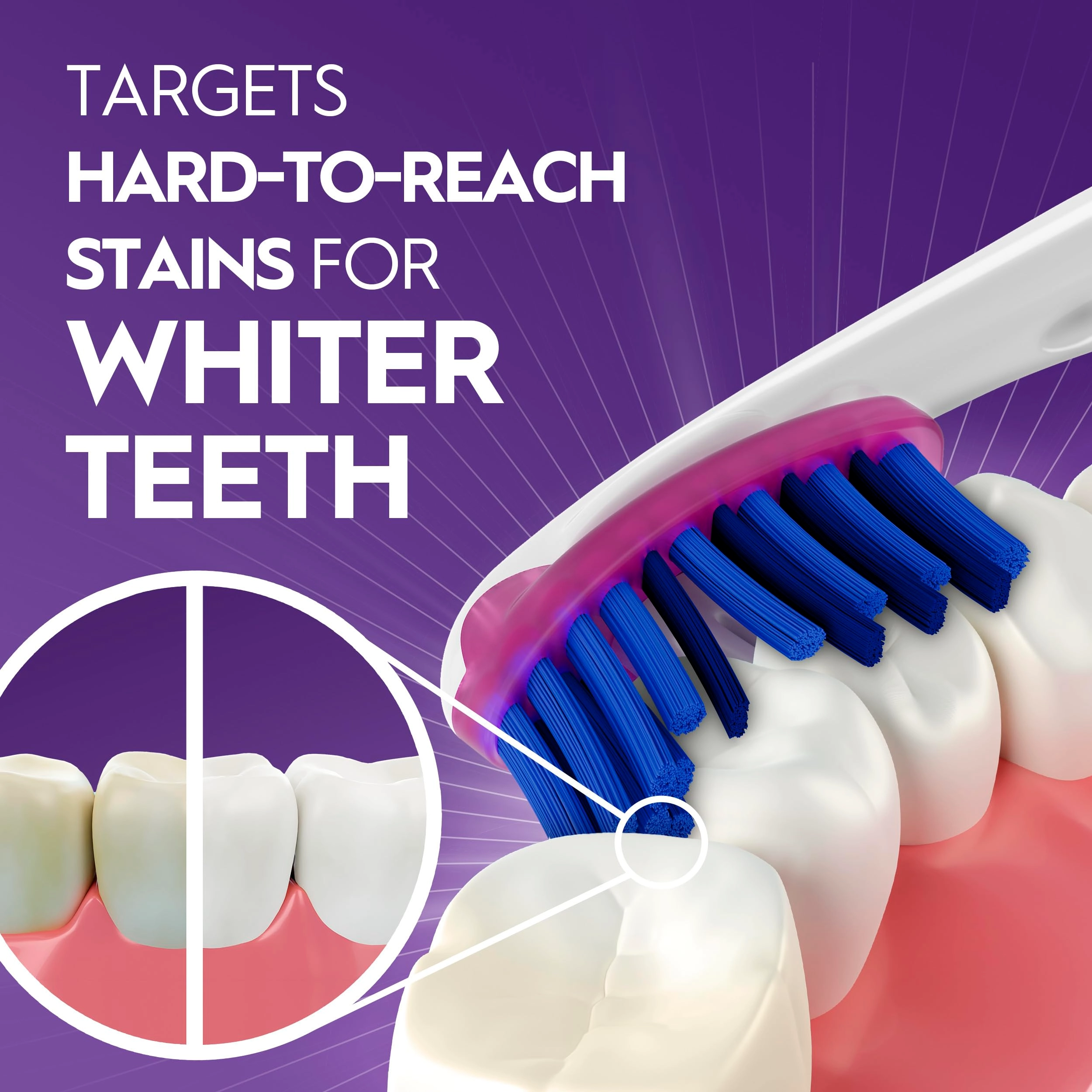 Pro-Flex Stain Eraser - Soft