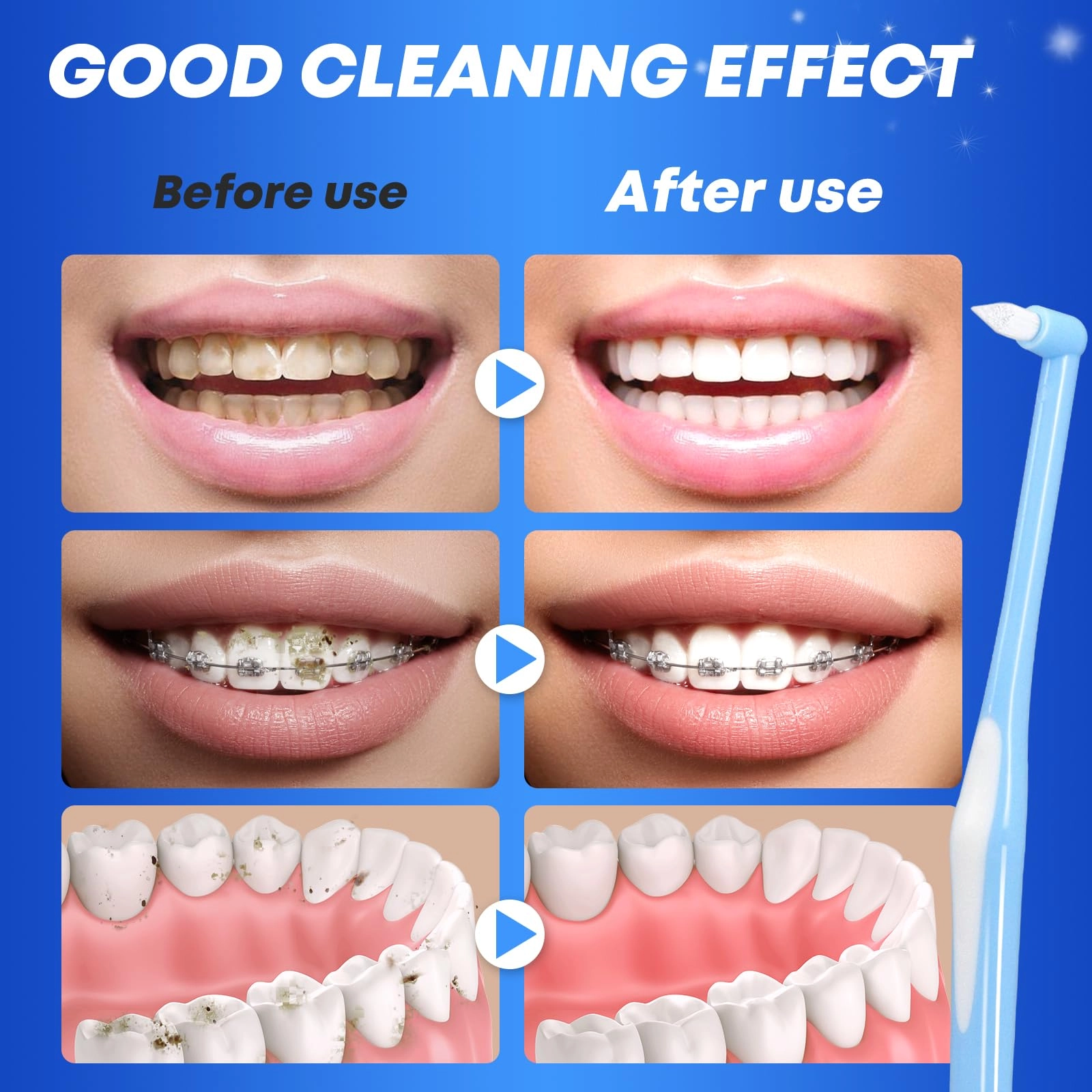 Interspace Toothbrushes