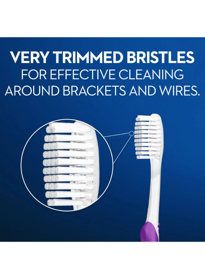 Pro-Expert Ortho Orthodontic 35 - Soft