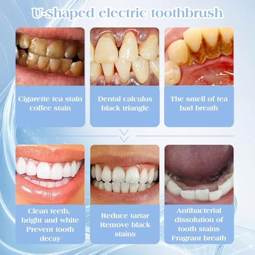 U-Shaped Toothbrush - 360° Deep Cleaning 3 Cleaning Modes LED Blue Light