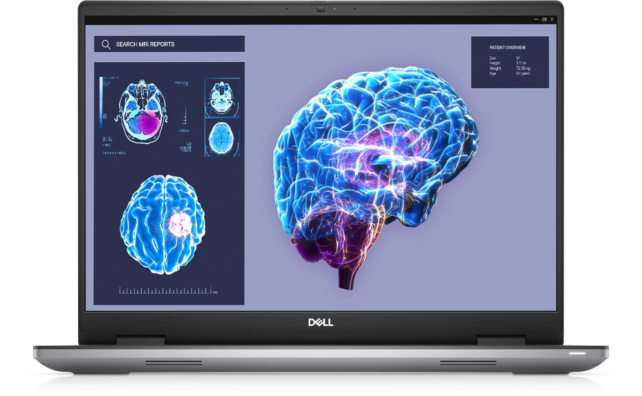 DELL Precision 7000 7680 - 16'' i7-13850HX 32GB DDR5 512GB SSD